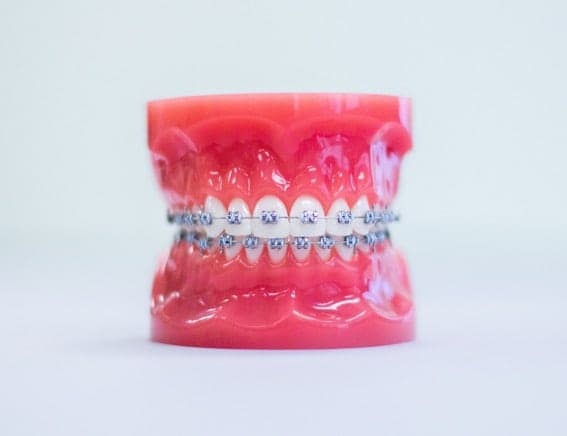 Braces & Invisalign Treatment