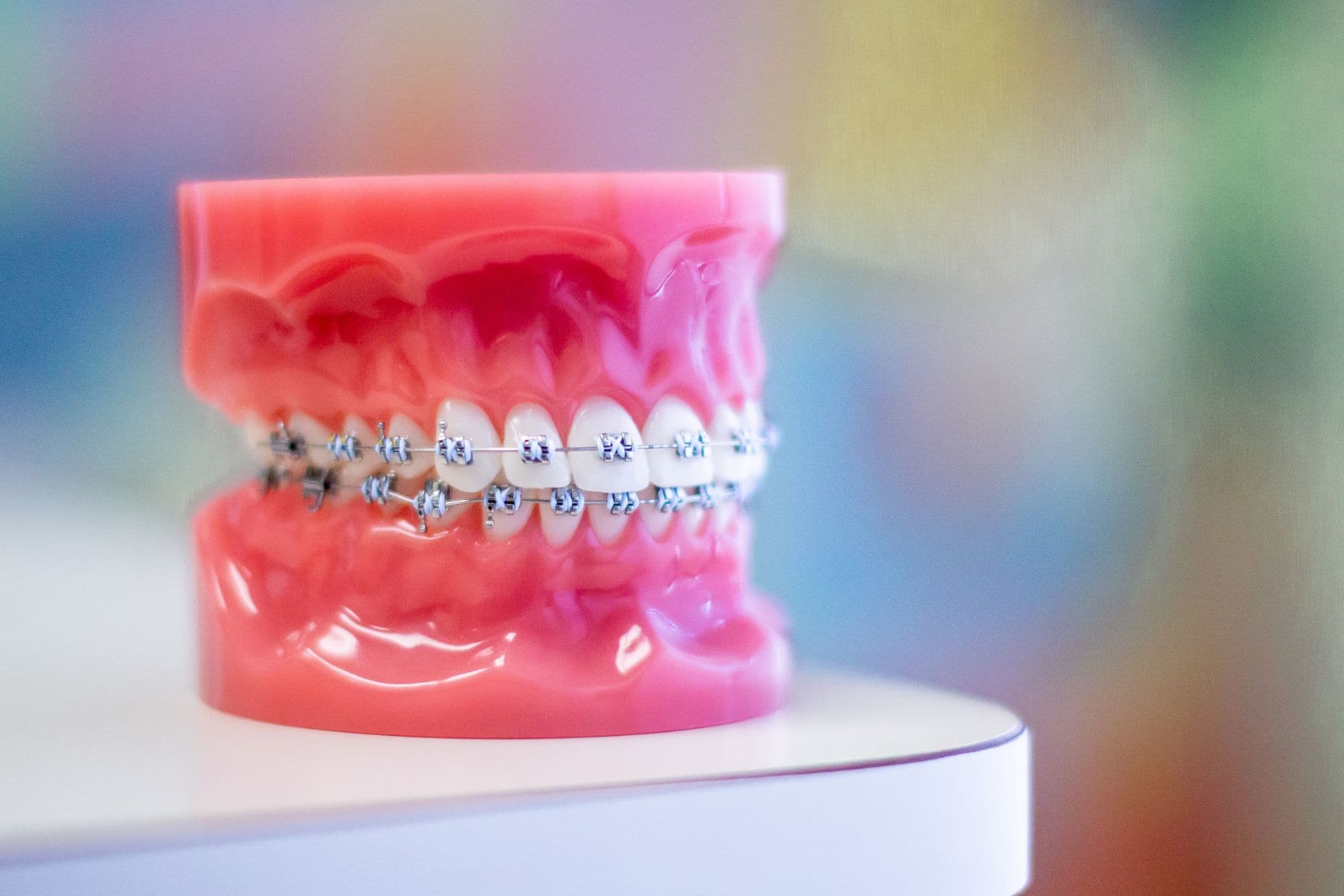 braces logan UT