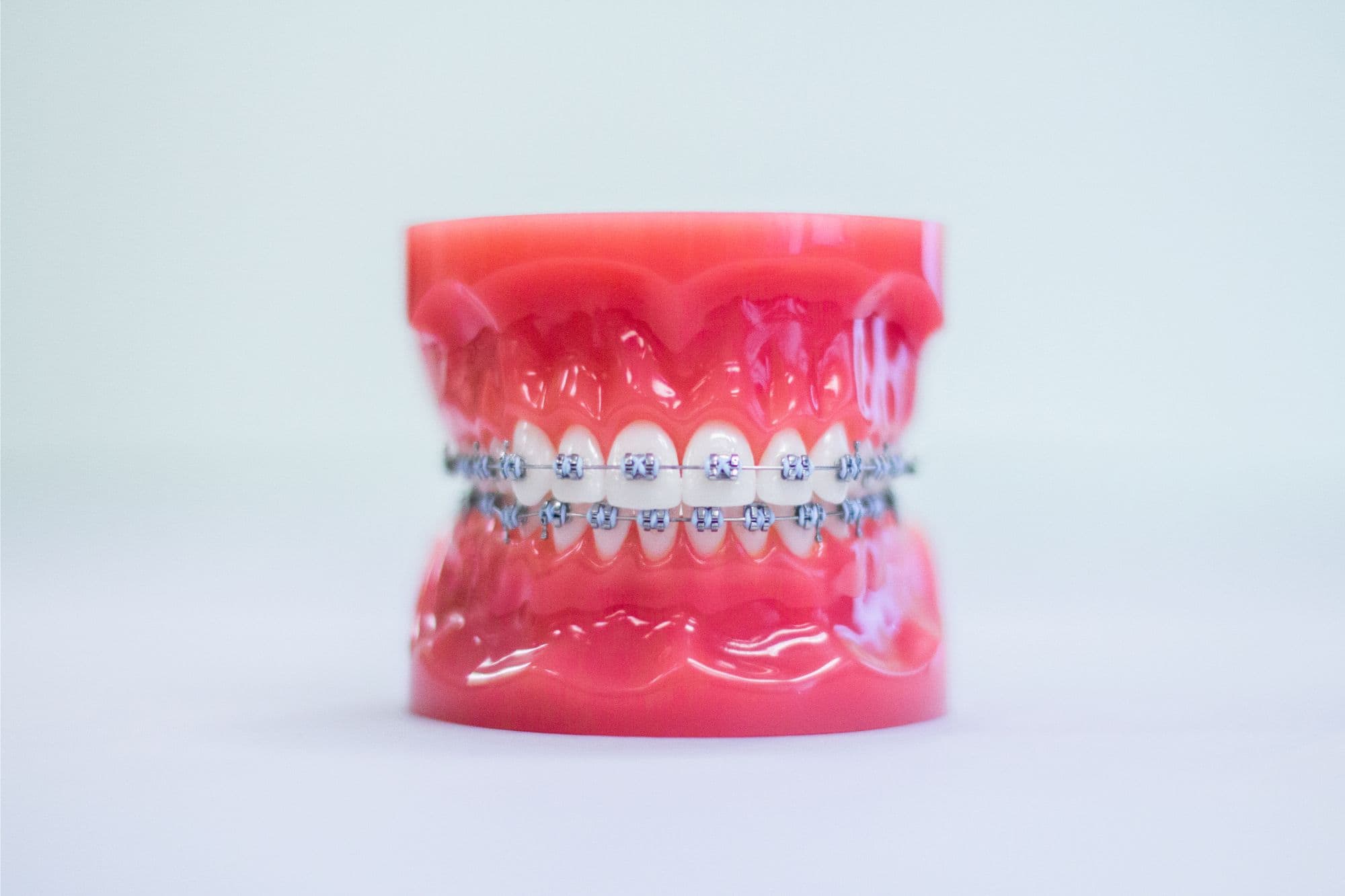 Logan Orthodontics - Metal Braces